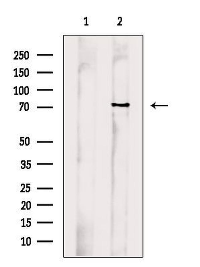 Fibulin 1 Antibody in Western Blot (WB)