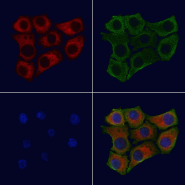 FOLR2 Antibody in Immunocytochemistry (ICC/IF)