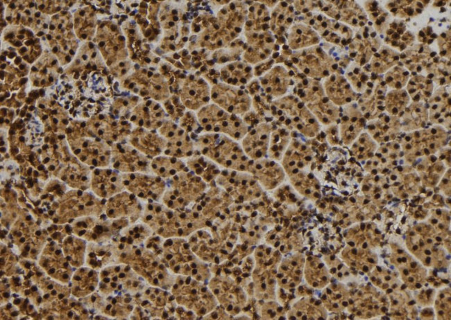 QSER1 Antibody in Immunohistochemistry (Paraffin) (IHC (P))