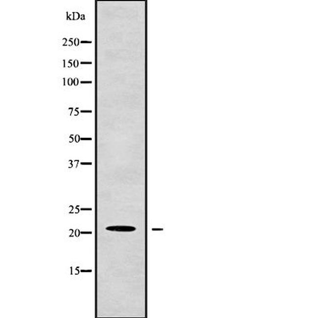 G-CSF Antibody in Western Blot (WB)