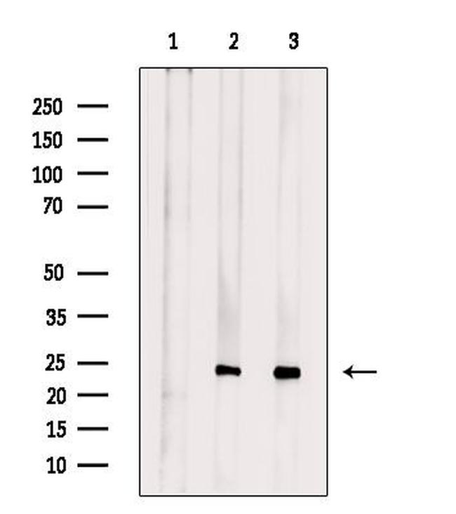 GCH1 Antibody in Western Blot (WB)