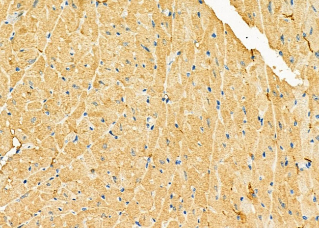 GUCA2B Antibody in Immunohistochemistry (Paraffin) (IHC (P))