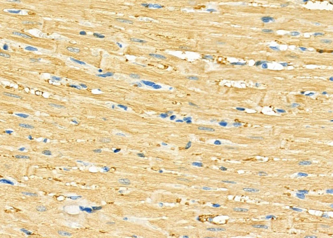 GUCA2B Antibody in Immunohistochemistry (Paraffin) (IHC (P))