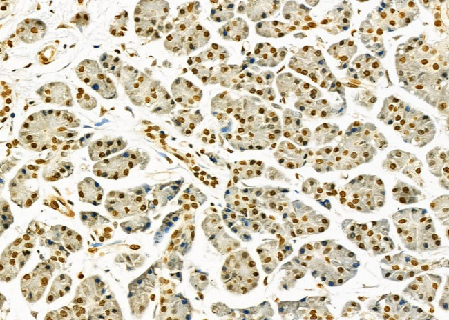 HEATR1 Antibody in Immunohistochemistry (Paraffin) (IHC (P))