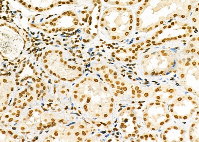 HEATR1 Antibody in Immunohistochemistry (Paraffin) (IHC (P))