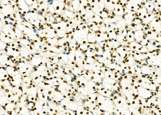 HEATR1 Antibody in Immunohistochemistry (Paraffin) (IHC (P))