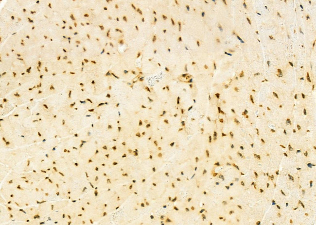 HEATR1 Antibody in Immunohistochemistry (Paraffin) (IHC (P))