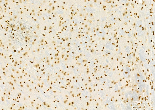 HEATR1 Antibody in Immunohistochemistry (Paraffin) (IHC (P))