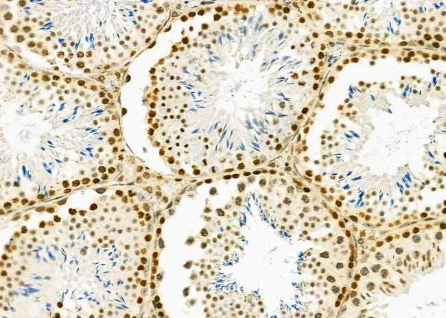 HEATR1 Antibody in Immunohistochemistry (Paraffin) (IHC (P))