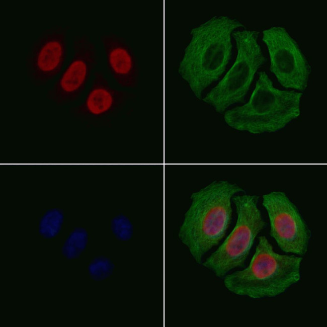 hnRNP DL Antibody in Immunocytochemistry (ICC/IF)