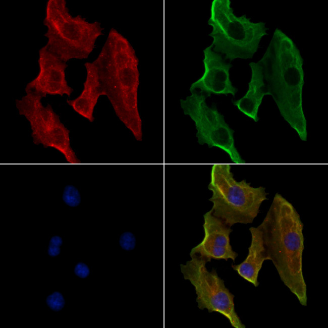 HLA-DMB Antibody in Immunocytochemistry (ICC/IF)