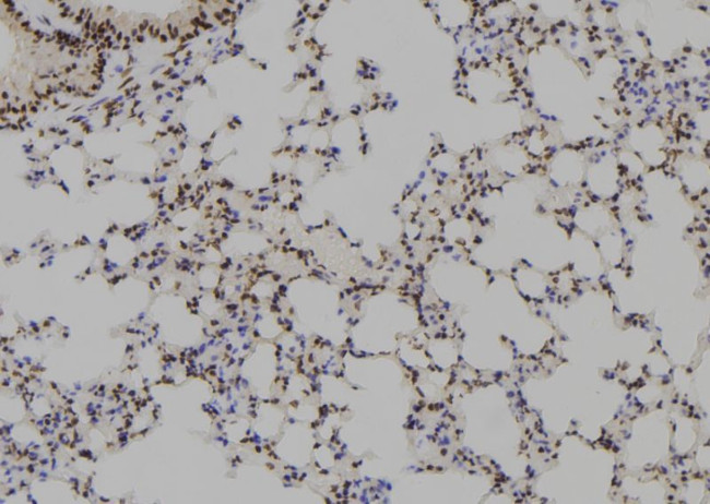 HOXB1 Antibody in Immunohistochemistry (Paraffin) (IHC (P))