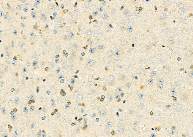 HOXB3 Antibody in Immunohistochemistry (Paraffin) (IHC (P))