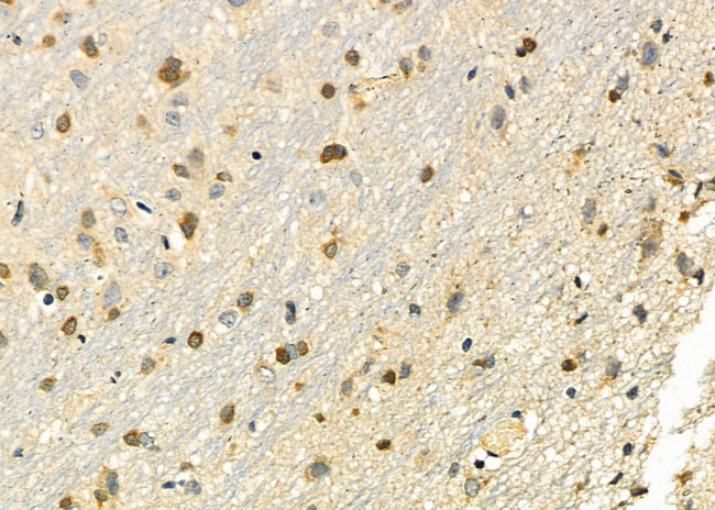 HOXB3 Antibody in Immunohistochemistry (Paraffin) (IHC (P))