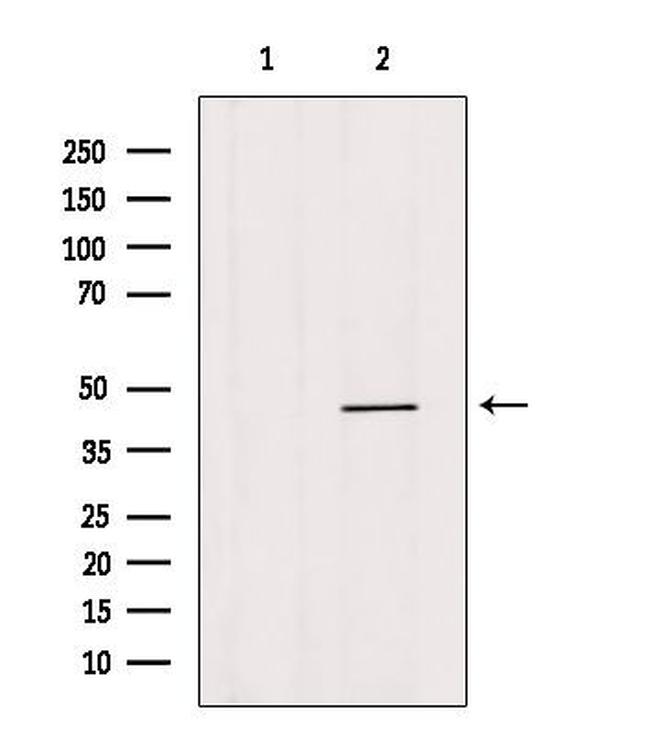 HOXB3 Antibody in Western Blot (WB)