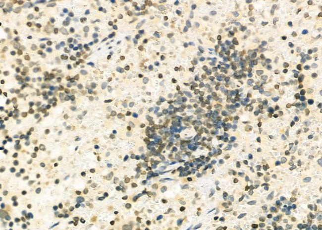 NKX6-2 Antibody in Immunohistochemistry (Paraffin) (IHC (P))