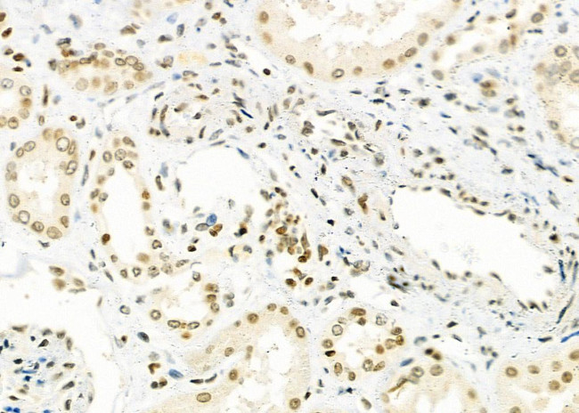 NKX6-2 Antibody in Immunohistochemistry (Paraffin) (IHC (P))