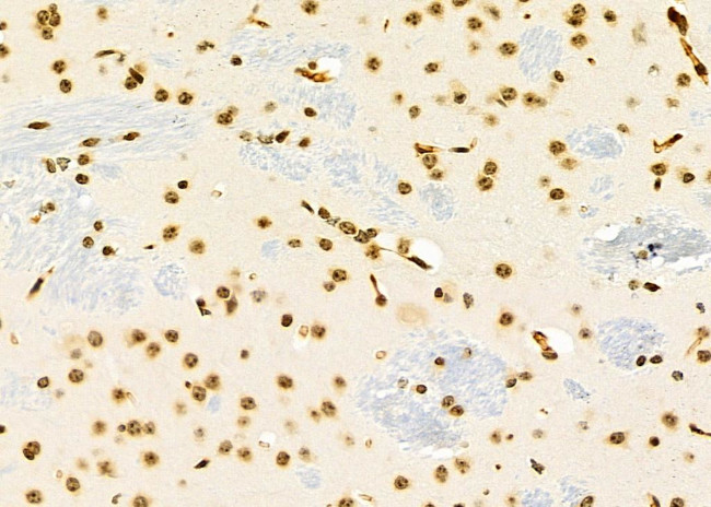 NKX6-2 Antibody in Immunohistochemistry (Paraffin) (IHC (P))