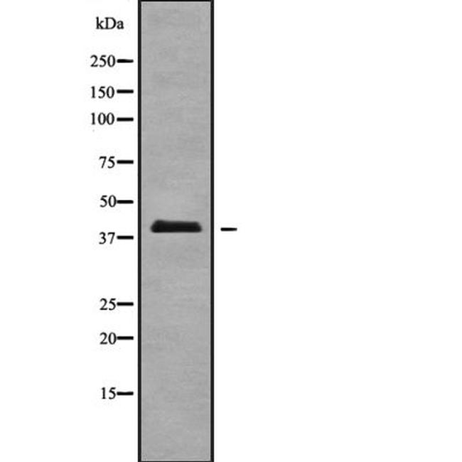 A4GALT Antibody in Western Blot (WB)