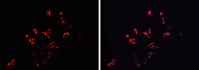 IMMP2L Antibody in Immunocytochemistry (ICC/IF)