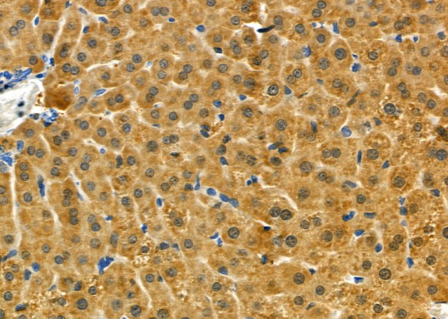 IMMP2L Antibody in Immunohistochemistry (Paraffin) (IHC (P))