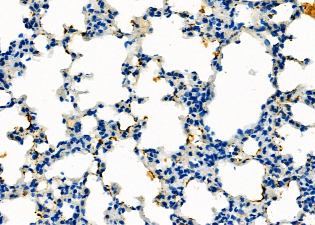 IMMP2L Antibody in Immunohistochemistry (Paraffin) (IHC (P))