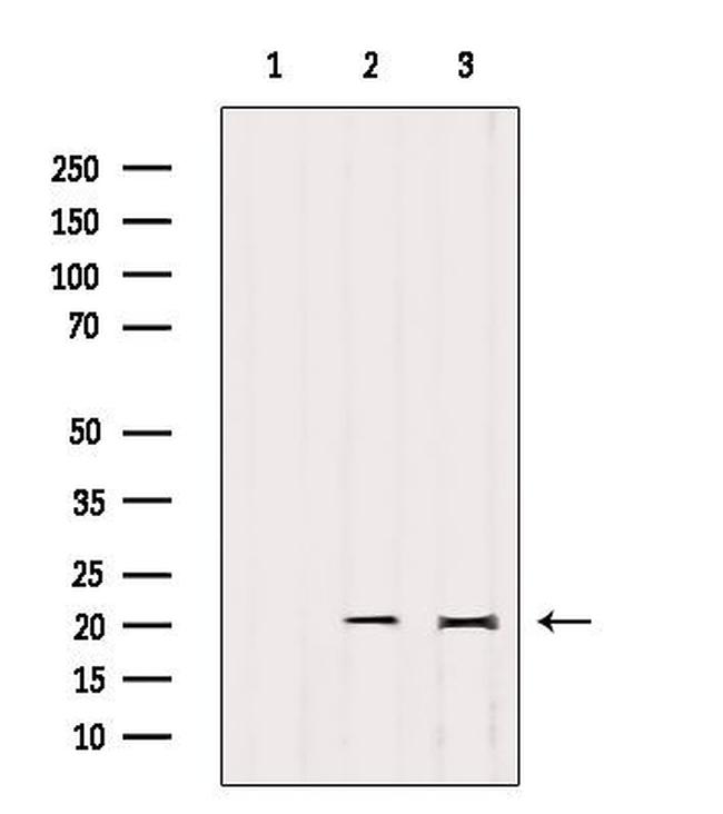 IMMP2L Antibody in Western Blot (WB)