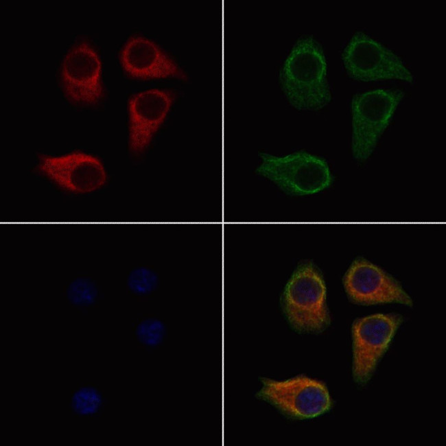 MCT5 Antibody in Immunocytochemistry (ICC/IF)