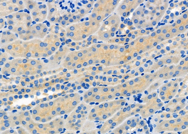 MCT5 Antibody in Immunohistochemistry (Paraffin) (IHC (P))