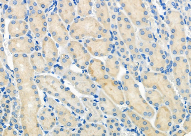 MCT5 Antibody in Immunohistochemistry (Paraffin) (IHC (P))