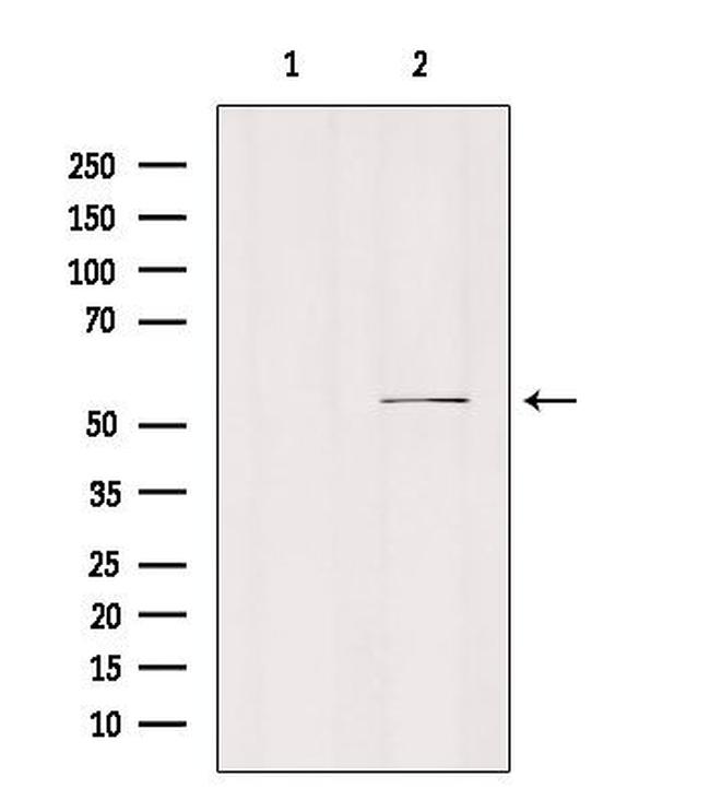 MCT5 Antibody in Western Blot (WB)