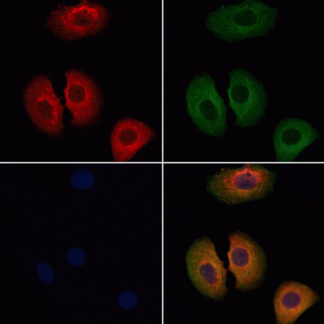 MUC5B Antibody in Immunocytochemistry (ICC/IF)