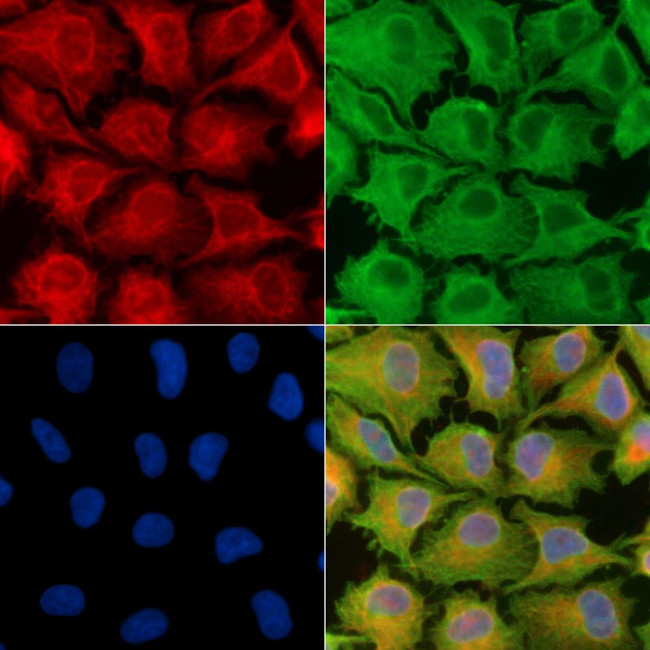 NDUFB7 Antibody in Immunocytochemistry (ICC/IF)