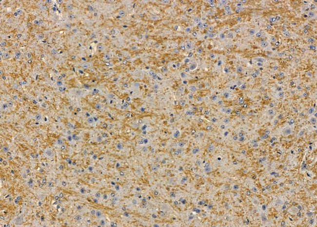 NDUFB7 Antibody in Immunohistochemistry (Paraffin) (IHC (P))