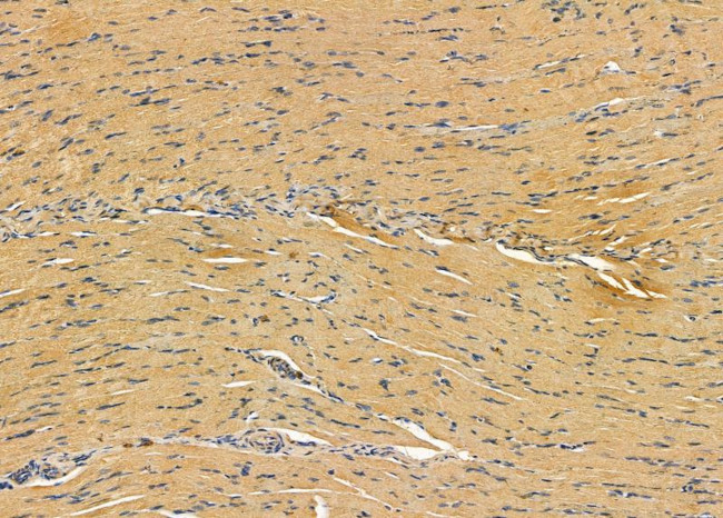 NDUFB7 Antibody in Immunohistochemistry (Paraffin) (IHC (P))