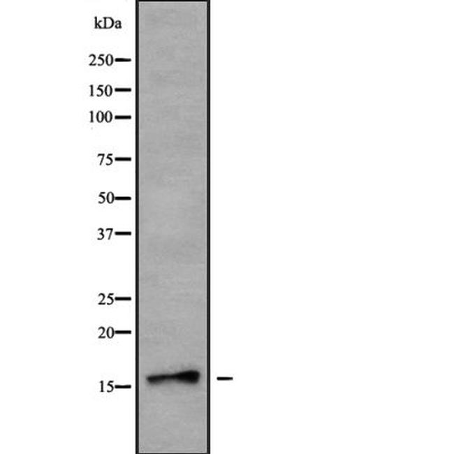 NDUFB7 Antibody in Western Blot (WB)