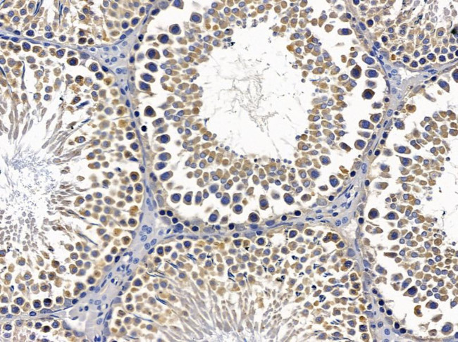 NKp44 Antibody in Immunohistochemistry (Paraffin) (IHC (P))