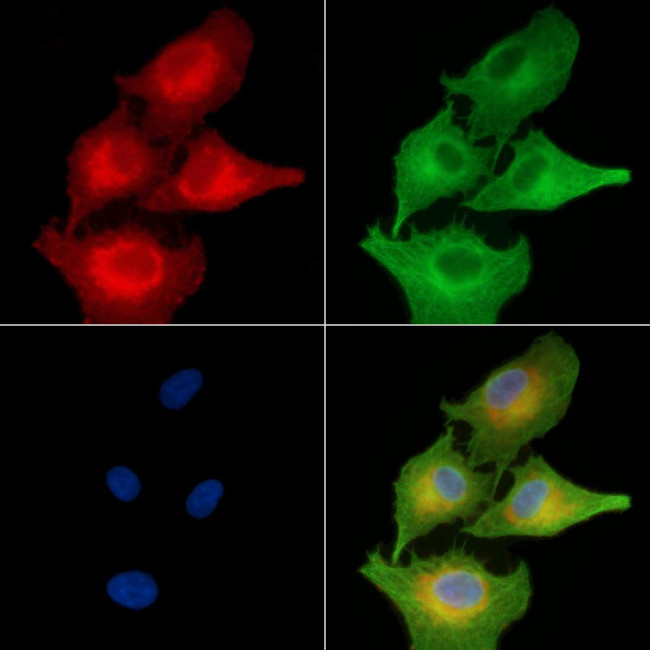 NPHP1 Antibody in Immunocytochemistry (ICC/IF)