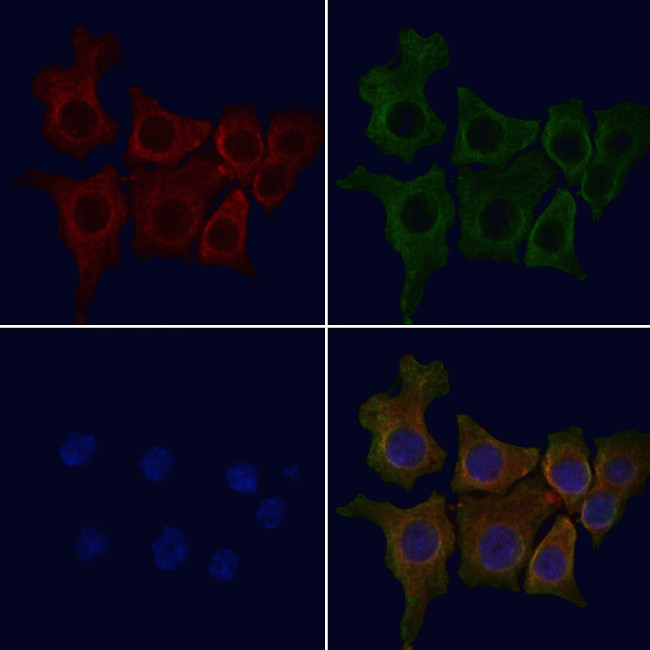 UNC5A Antibody in Immunocytochemistry (ICC/IF)