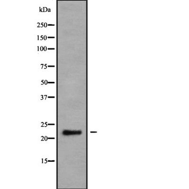 Neurensin 2 Antibody in Western Blot (WB)