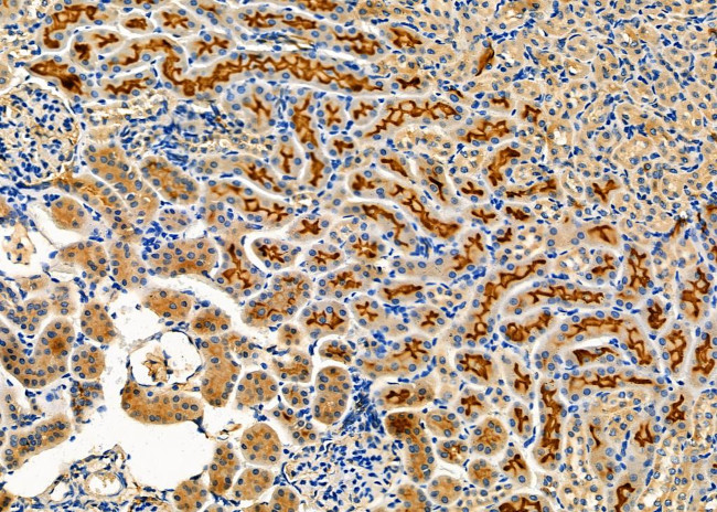 NXPH2 Antibody in Immunohistochemistry (Paraffin) (IHC (P))