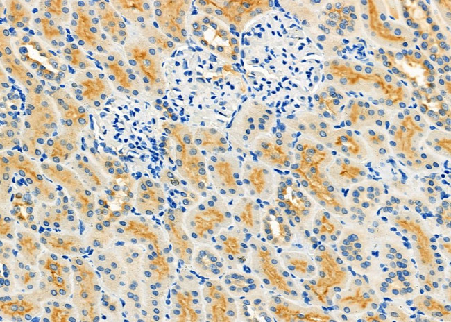 NXPH2 Antibody in Immunohistochemistry (Paraffin) (IHC (P))