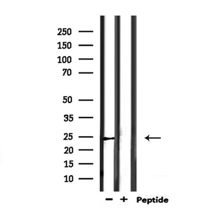 SCG5 Antibody in Western Blot (WB)