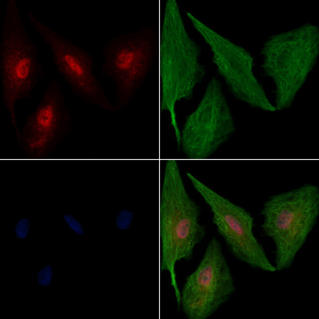 NAV2 Antibody in Immunocytochemistry (ICC/IF)