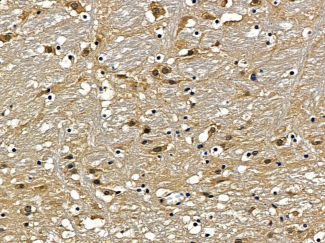 NAV2 Antibody in Immunohistochemistry (Paraffin) (IHC (P))