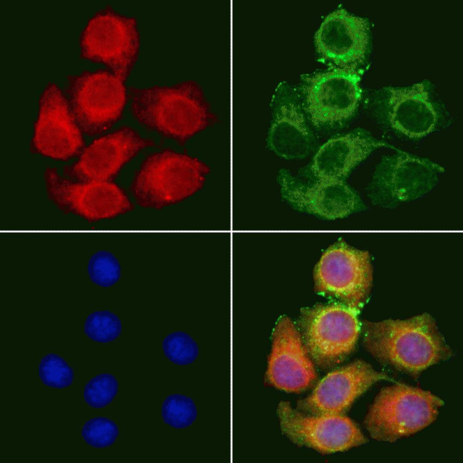 DFNA5 Antibody in Immunocytochemistry (ICC/IF)