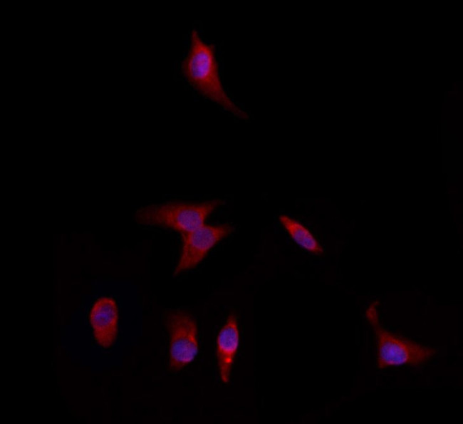 DFNA5 Antibody in Immunocytochemistry (ICC/IF)