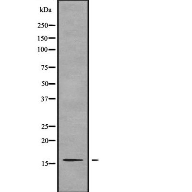 TNP2 Antibody in Western Blot (WB)