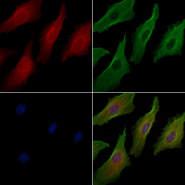 NOP14 Antibody in Immunocytochemistry (ICC/IF)