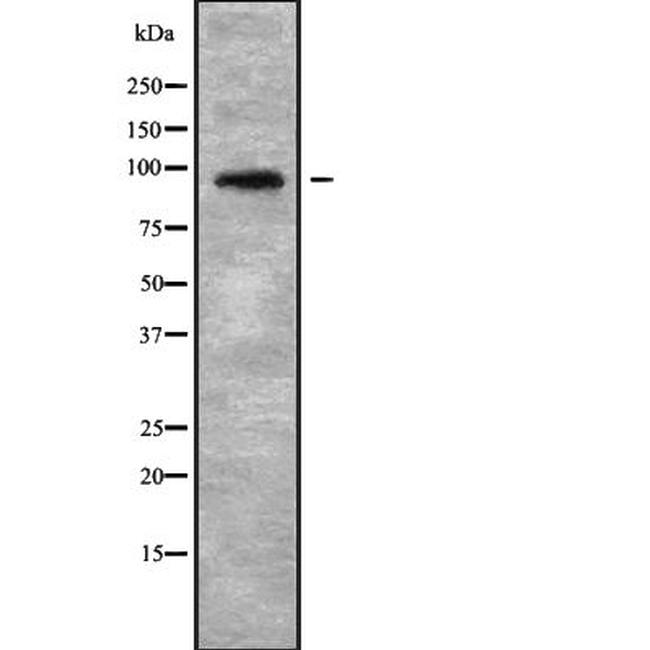 NOP14 Antibody in Western Blot (WB)